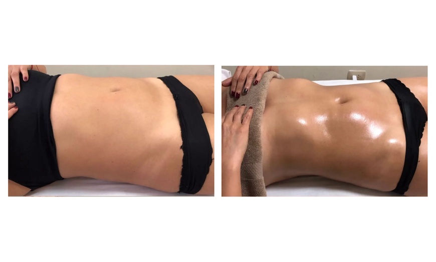 Image 6: 1, 2 o 4 sesiones de drenaje linfático brasileño en una zona a elegir 