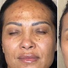 Image 2: Achieve Radiant Skin: Microdermabrasion Facial
