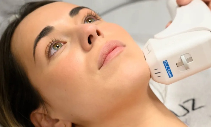 Image 2: 1 o 2 sesiones de tratamiento HIFU facial o corporal para 1 51% 
