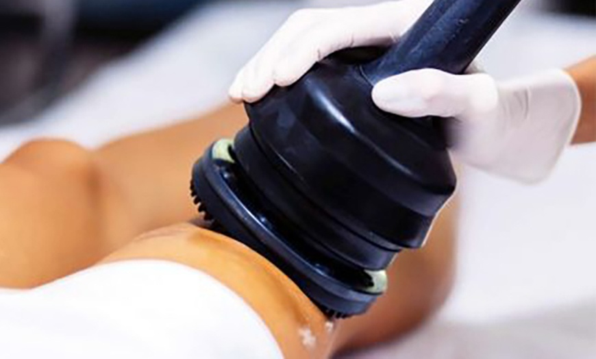 Image 1: 1, 5 oder 8x 20-30 Min. G5-Massage Cellulitisbehandlung für 1 Person