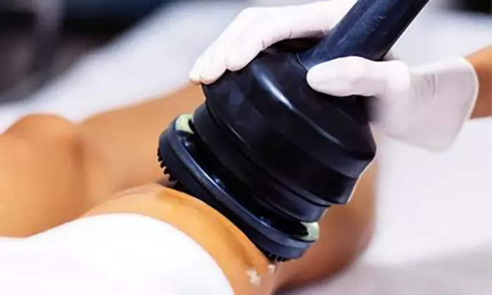 1, 5 oder 8x 20-30 Min. G5-Massage Cellulitisbehandlung für 1 Person