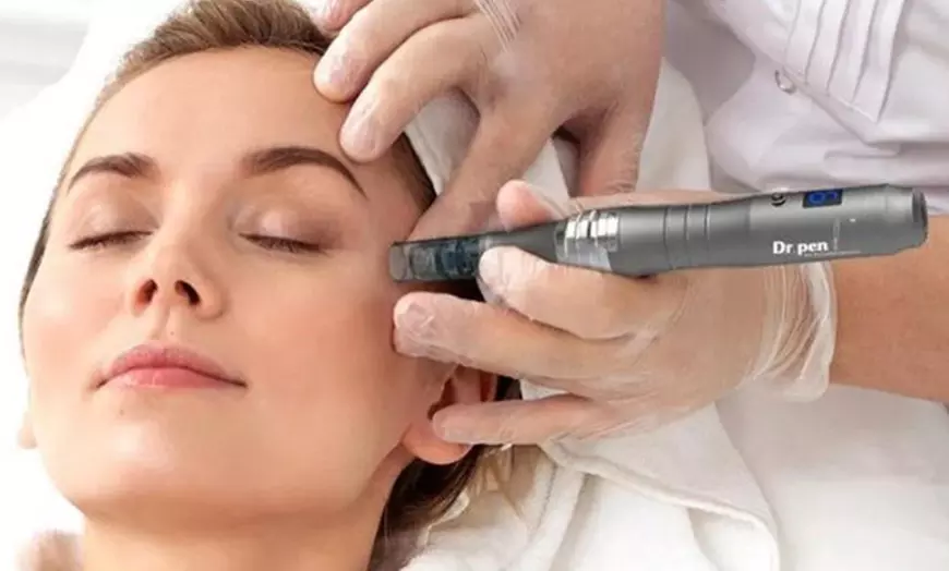 Image 1: Experience Face & Neck Microneedling + RF Skin Tightening or More