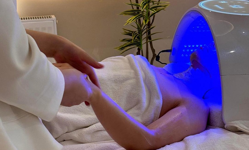 Image 3: Christmas Special: One Area Skin Needling with LED Therapy