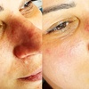 Image 2: Aqua-Facial, Microneedling, Wimpern- / Augenbrauen-Lifiting für 1 P.