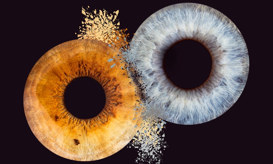 Image 2: Iris-Fotoshooting für 1 - 3 Iriden ohne Effekt inkl. Bild als Datei