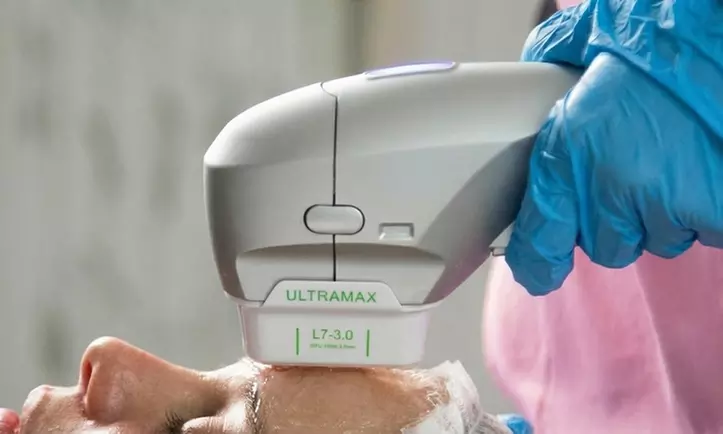 Tratamiento HIFU 22D facial en zona a elegir y radiofrecuencia