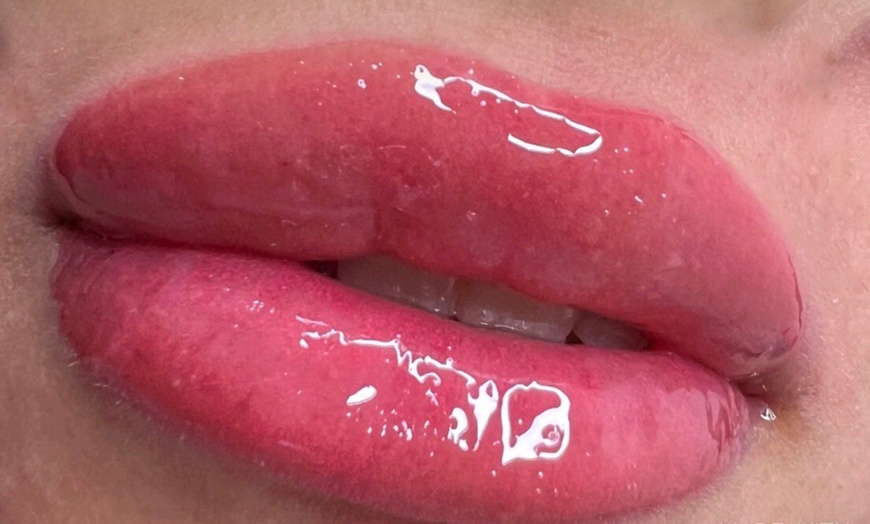 Image 15: 1 o 2 sesiones de rehidratación de labios o microlifting facial para 1