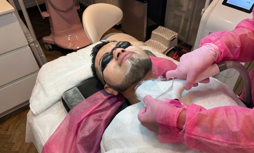 Image 2: Six Laser Hair Removal for Small, Medium, Large or Extra Large Areas