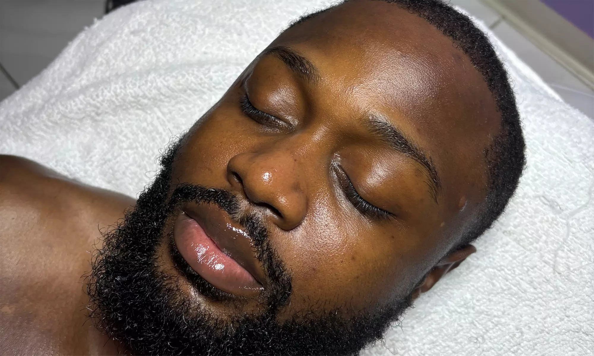 Deep Cleansing & Deep Pore Facials + Extractions, Enzyme & LED Therapy