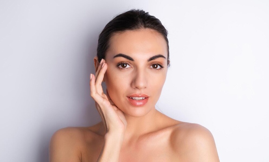 Image 1: 1 o 2 sesiones de microlifting facial con vitaminas con Dermapen