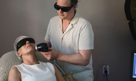 1x laserbehandeling voor het verminderen van vlekken, couperose, pigment of acne (max. 10 cm²) - Pink Laser Clinic