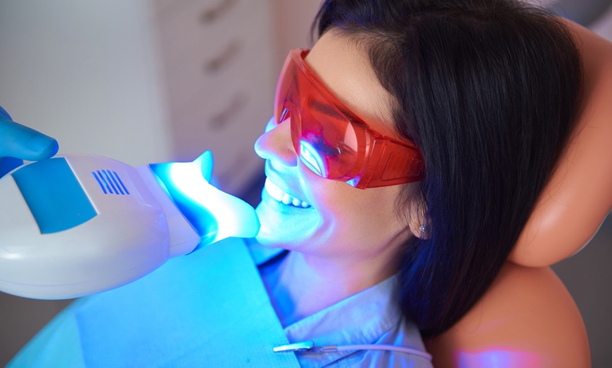 Image 2: Teeth Whitening - In-Office - Non-Branded at Splendida