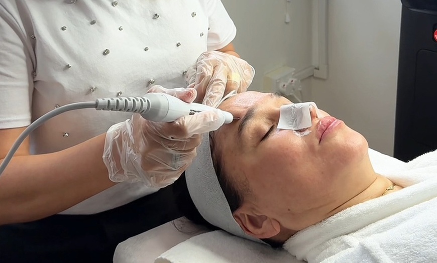 Image 5: Fibroblast Treatment