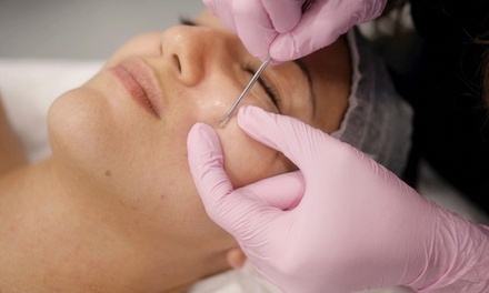60 Minute Hydrafacial with Extractions, High Frequency and Hydrogel or Charcoal Mask - The Laser Lab