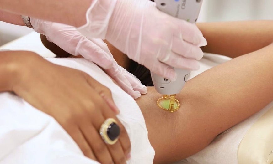 Image 5: Get Laser Hair Removal for Bikini, Brazilian, Legs, Neck & More
