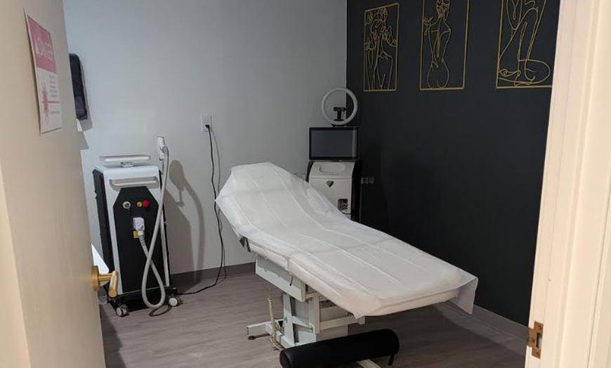 Image 6: Tattoo Removal Sessions