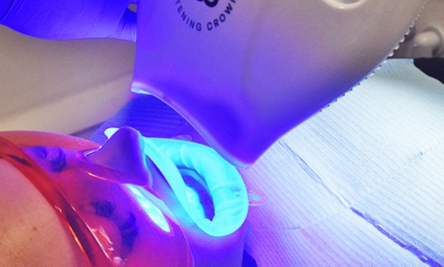 Image 1: In-Office Crown Whitening with Consultation and Optional Whitening Kit