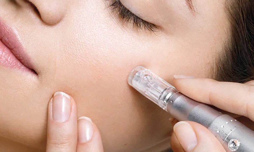 Image 1: Dermapen facial con ácido hialurónico, vitaminas y terapia LED