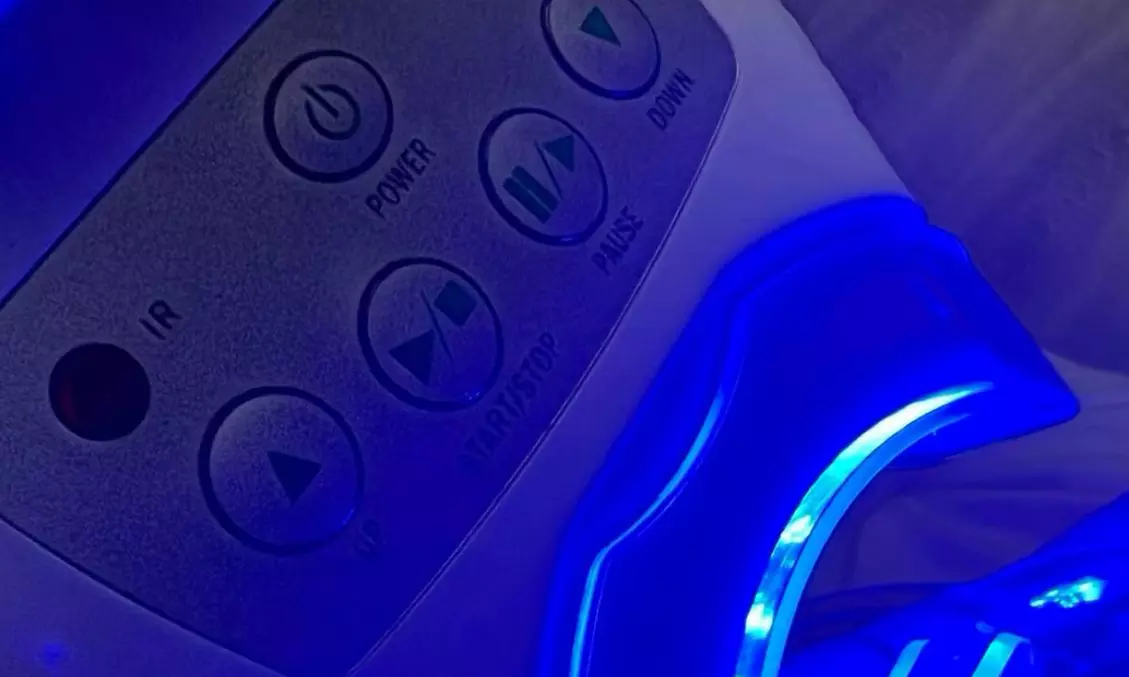 Kosmetisches Zahn-Bleaching, opt. Auffrischungsbehandlung, für 1 Pers.