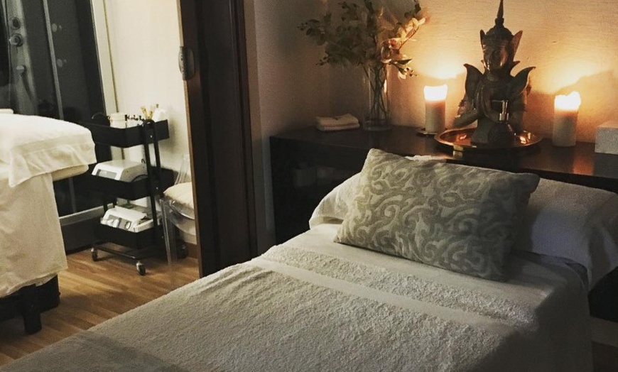 Image 3: 3, 5 o 7 sesiones de depilación láser SHR en 1 zona o cuerpo entero