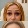 Image 1: Turn Back Time w/ 20, or 40 Units of Botox