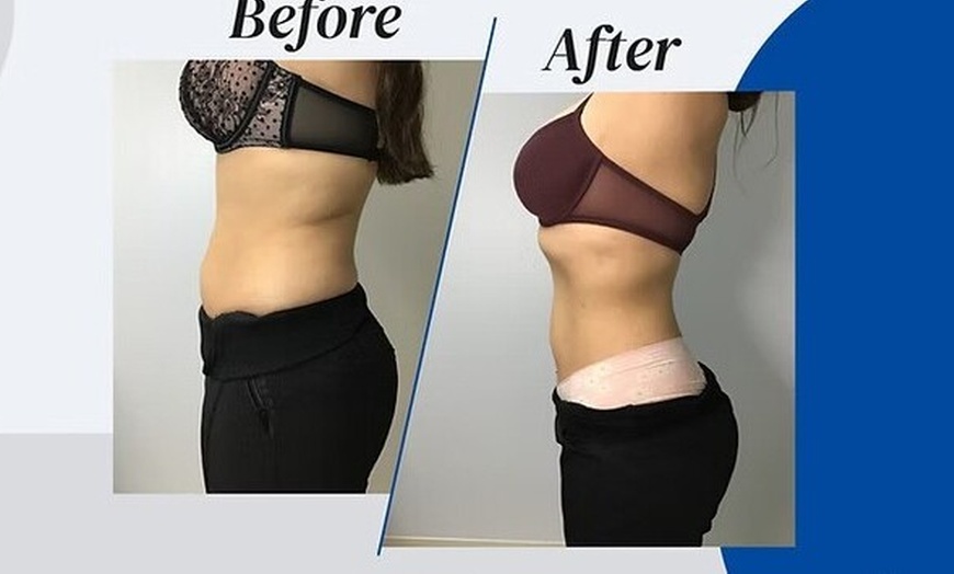 Image 3: Transform Your Body with Three or Six Sessions of EMS Sessions 