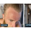 Image 5: Big Savings on Customized Rx Hair Growth Solutions and Receive A Free Dermatologist Consultation at Happy Head
