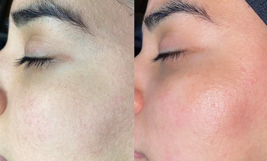 Image 2: Soin du visage hydratant, anti-âge ou coup d'éclat chez Mybodyfull