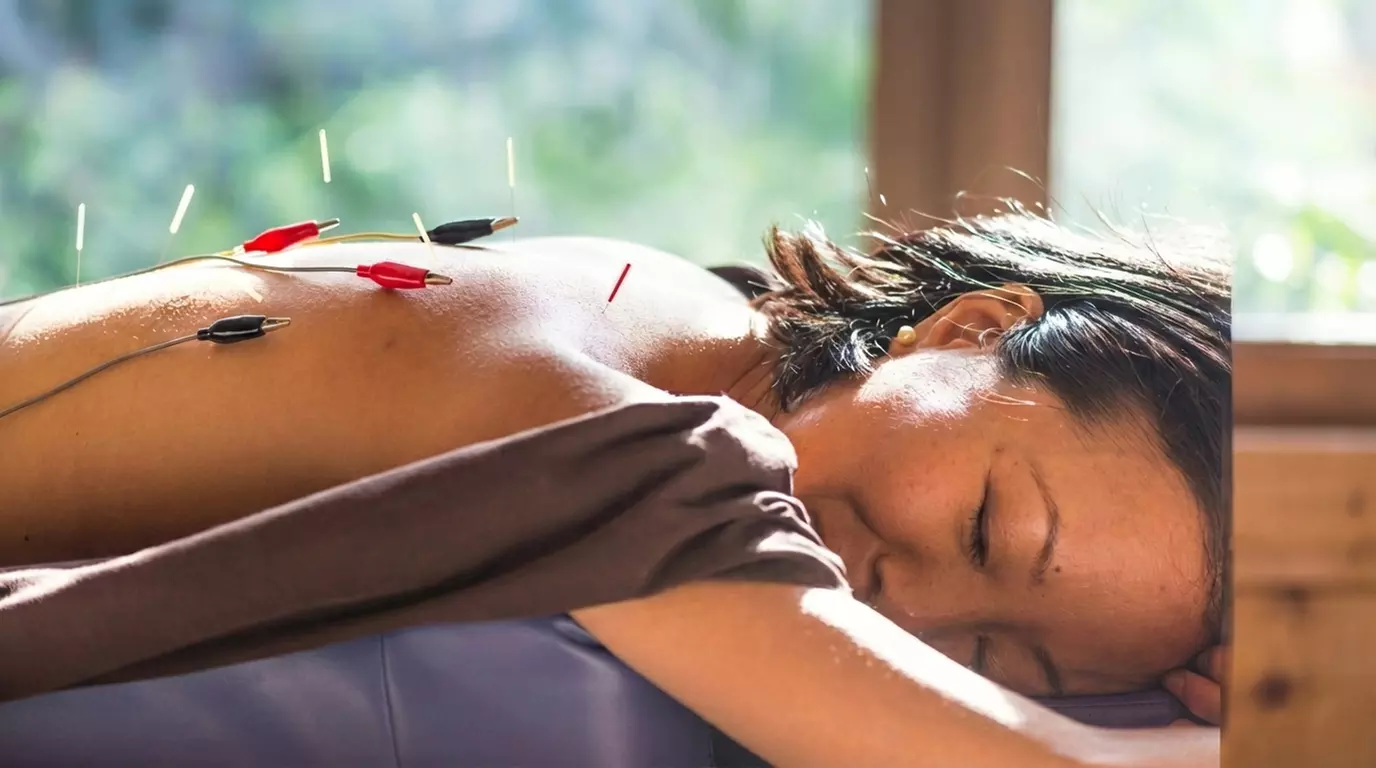 Rejuvenate with One, Three or Five Acupuncture Sessions at Essence of Life Wellness Center (Up to 48%Off) - Primary Image
