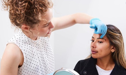 One Session of Dermapen Skin Needling for Full Face + LED Therapy - Elucell