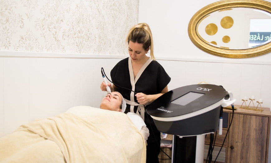 Image 2: 2 sesiones de maderoterapia con drenaje linfático para 1 persona de 50 minutos cada una; ahorra hasta un 70% 