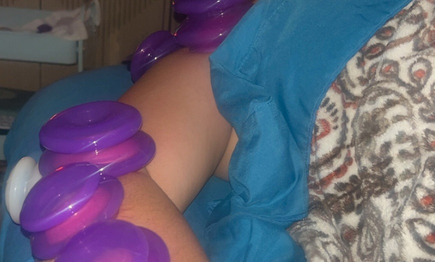 Image 4: Enhance Well-being with a 2-hour Acu-ssage or Acupuncture Treatment