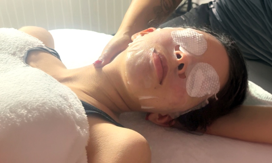 Image 7: Professional Facials & Microdermabrasion for Youthful, Radiant Skin
