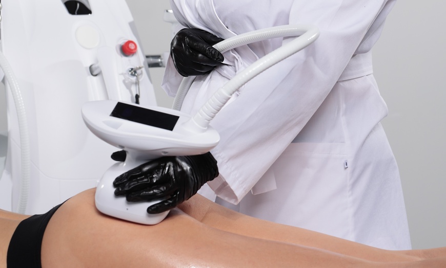 Image 1: Zabiegi na platformie ENDO z rolkami sferycznymi na wybrane partie