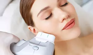 Revitalize with One or Two Sessions of HIFU for Face OR Neck at Infinity Aesthetics London (Up to 47% Off)
