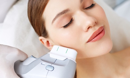 One Session of HIFU for Face OR Neck - Infinity Aesthetics London