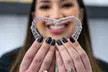 Perfect Smile w/ Invisalign Consult, all Necessary X-Rays & 3D Scan of Your Teeth @Zara Consult(Up to 56%Off)

 - Second Medium
