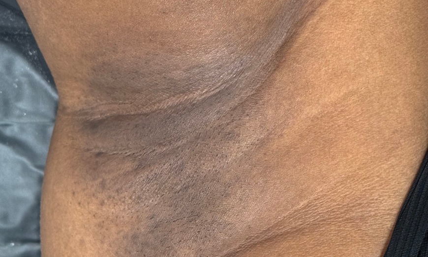 Image 9: Brazilian Waxing & Optional Eyebrow & Underarm Wax Combo