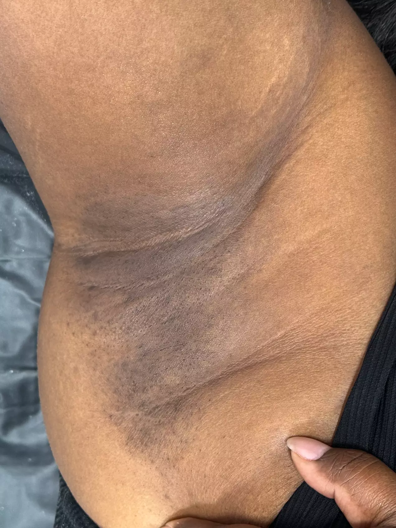 Brazilian Waxing & Optional Eyebrow & Underarm Wax Combo