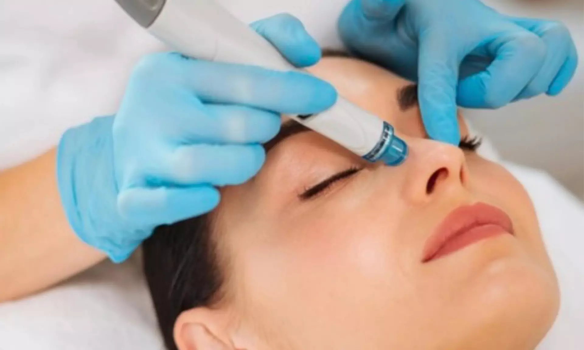 Glow With Microdermabrasion, Peels, HydraFacial, & LED Therapy Bliss