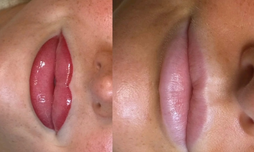 Image 8: Perfect Lips: Semi-Permanent Blush, Lip Liner & Dark Lip Correction