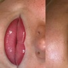 Image 8: Perfect Lips: Semi-Permanent Blush, Lip Liner & Dark Lip Correction