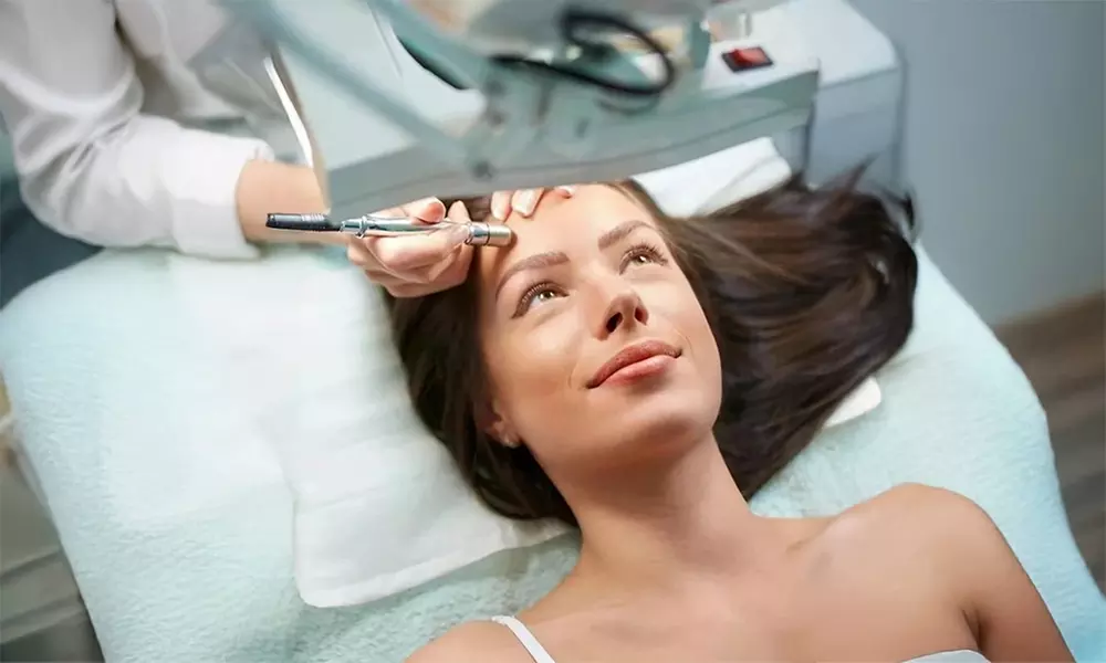 One or Two Microneedling Treatments with Hyaluronic Acid Serum at AZ Laser RX & Med Spa - Up to 68% Off - Primary Image