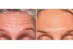 Up to 40% Off on Injection - Botox at River Oaks Galleria Medspa - Second Medium