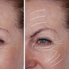 Image 2: Get One, Two, or Three Microcurrent Facelift Treatments