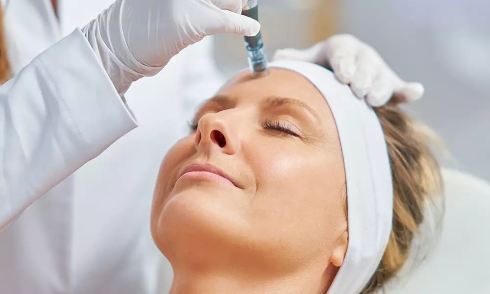 Exosomas con Dermapen en rostro completo, una o dos sesiones