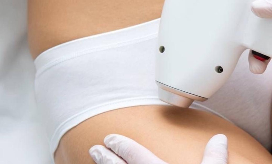 Image 5: Six Laser Hair-Removal Treatments for Every Area Size