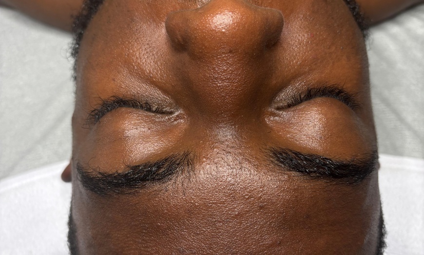 Image 1: Up to 50% Off on Men's Facial at Blossom Beauty Skincare