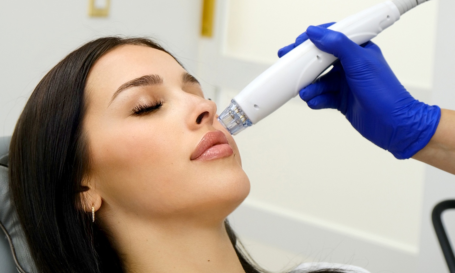 PRP Face and Hair Treatments for New Clients
