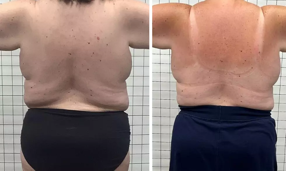 1, or 2 Muscle Building Body Sculpting Session for Abdomen or Buttocks